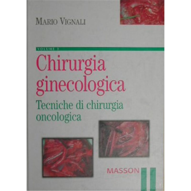 Chirurgia ginecologica - VOLUME 3 Tecniche di chirurgia oncologica